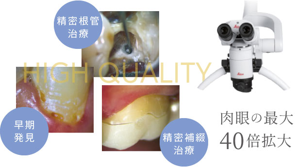 肉眼の最大40倍拡大、精密根管治療、早期発見、精密補綴治療