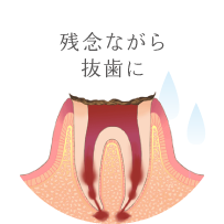 神経が死んでしまうと、痛みを感じなくなります